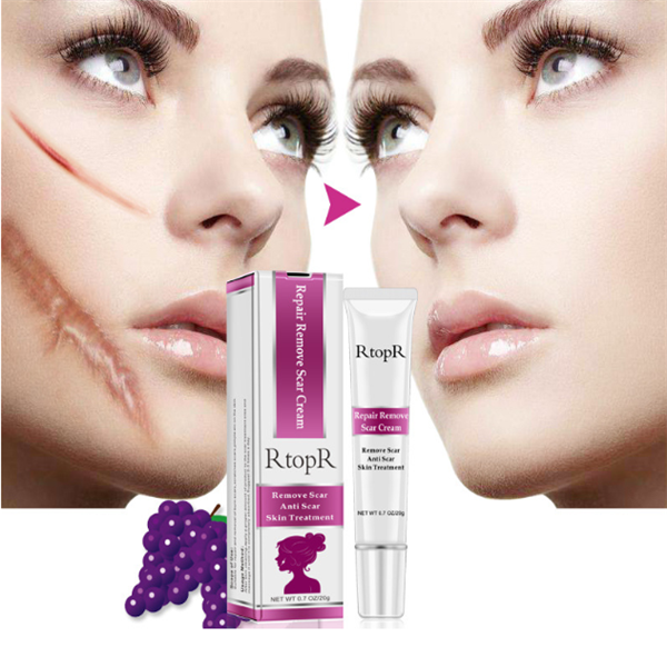 Skin Healing Acne Scar Cream